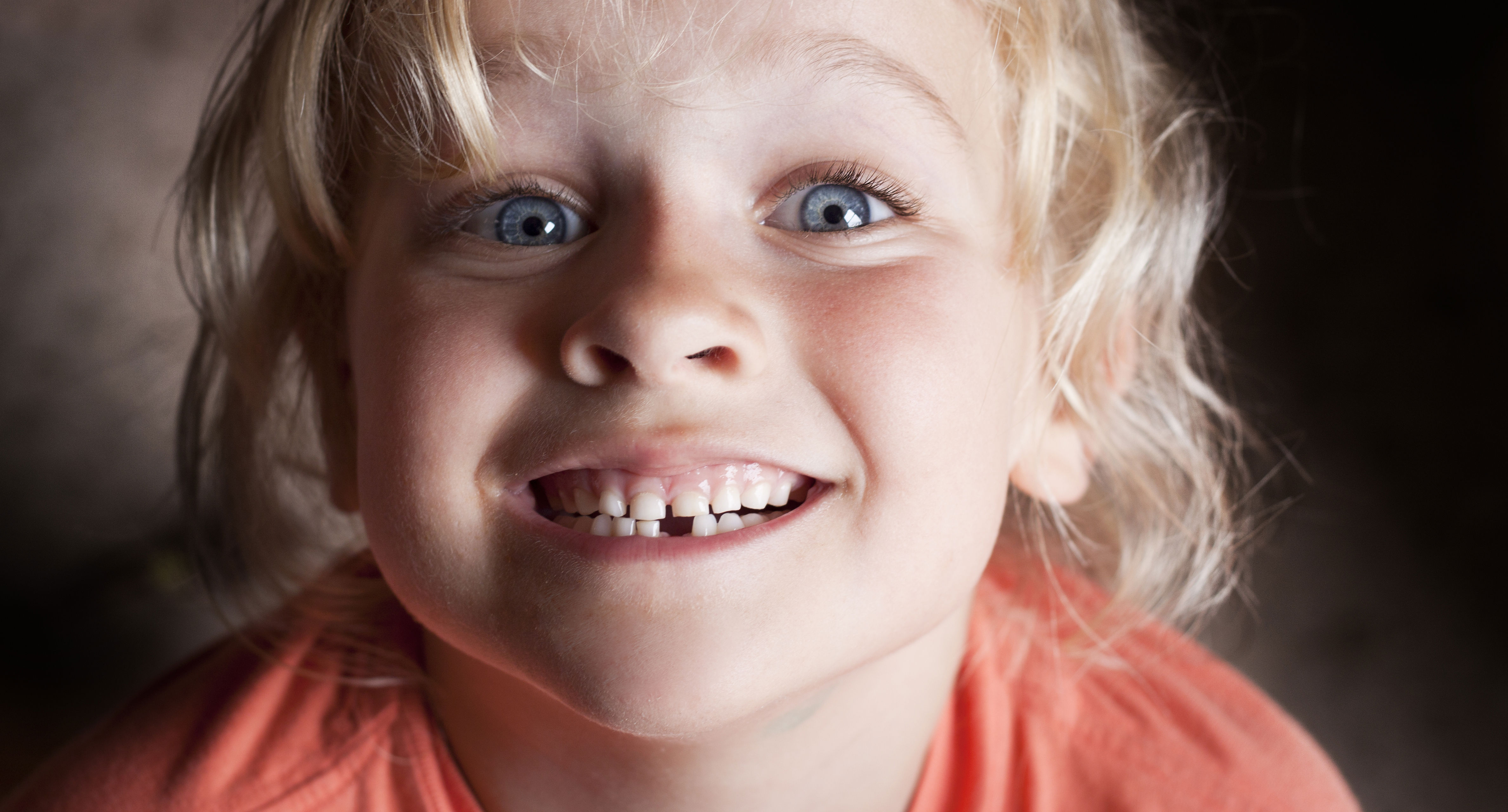 Barn, der viser sine tænder. En af fortænderne mangler. Barnet har tabt en mælketand.