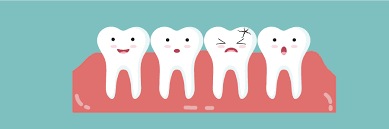 Tegning af fire tænder. Den tredje tand har et hul. Tænderne ved siden af den ser chokerede ud.